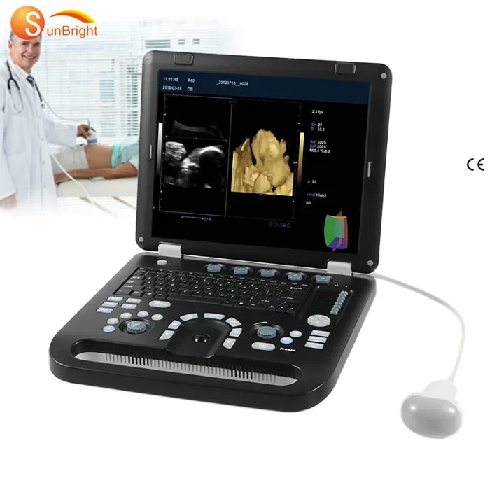 15 "Grande Schermo 3D 4D Color Doppler Pw Cw Laptop Portatile Ecografo Portatil Macchina Ad Ultrasuoni Per Test Cardiaco Professionale