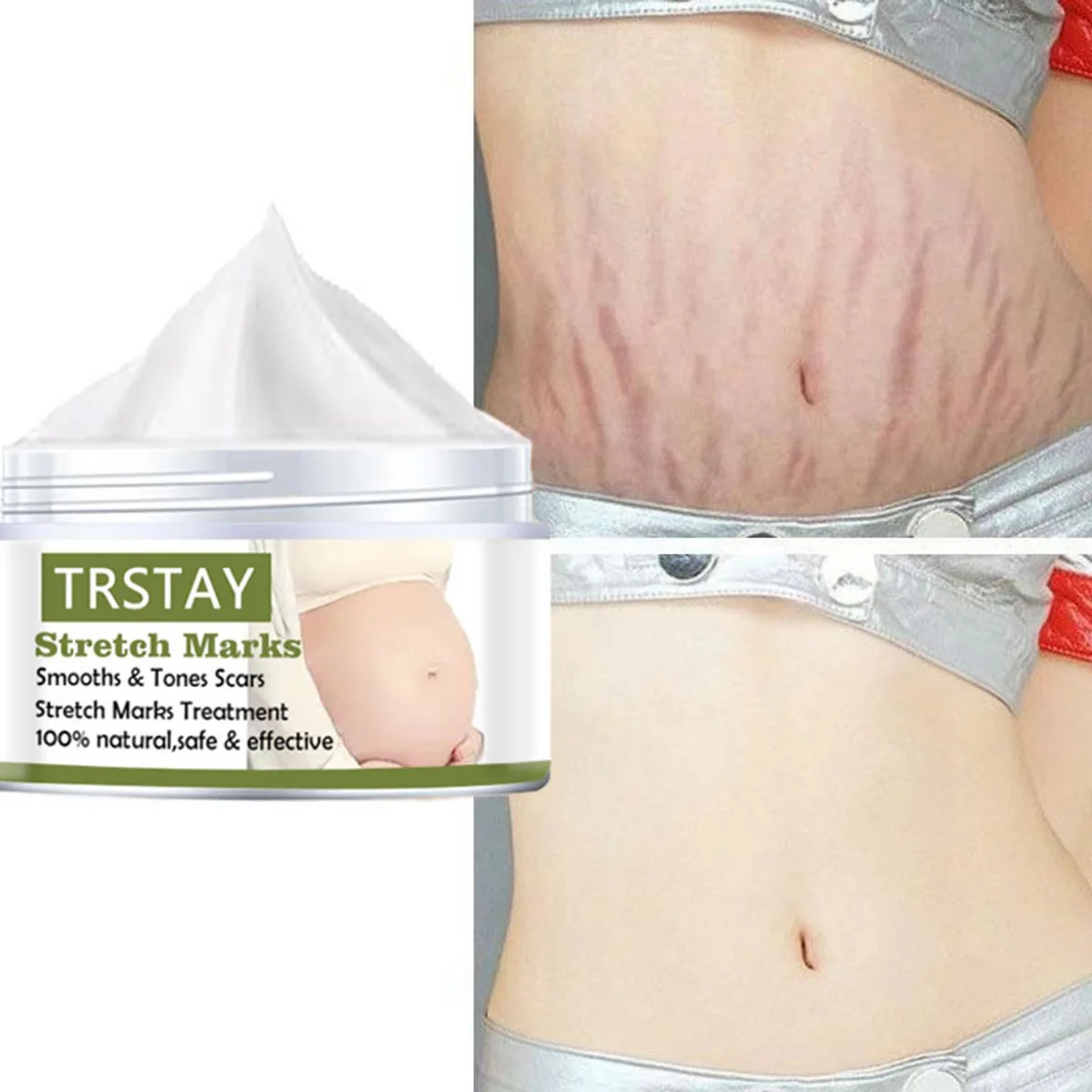 Pregnant Women's Belly Line Cream For Preventing Postpartum Pregnancy Lines Repair Cream 2