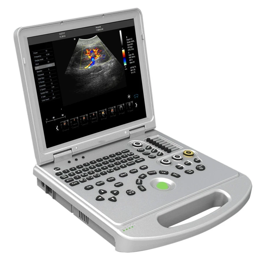 15 Pollici Led Ecografo Umano Portatil 2D Color Doppler Ultrasound Machine