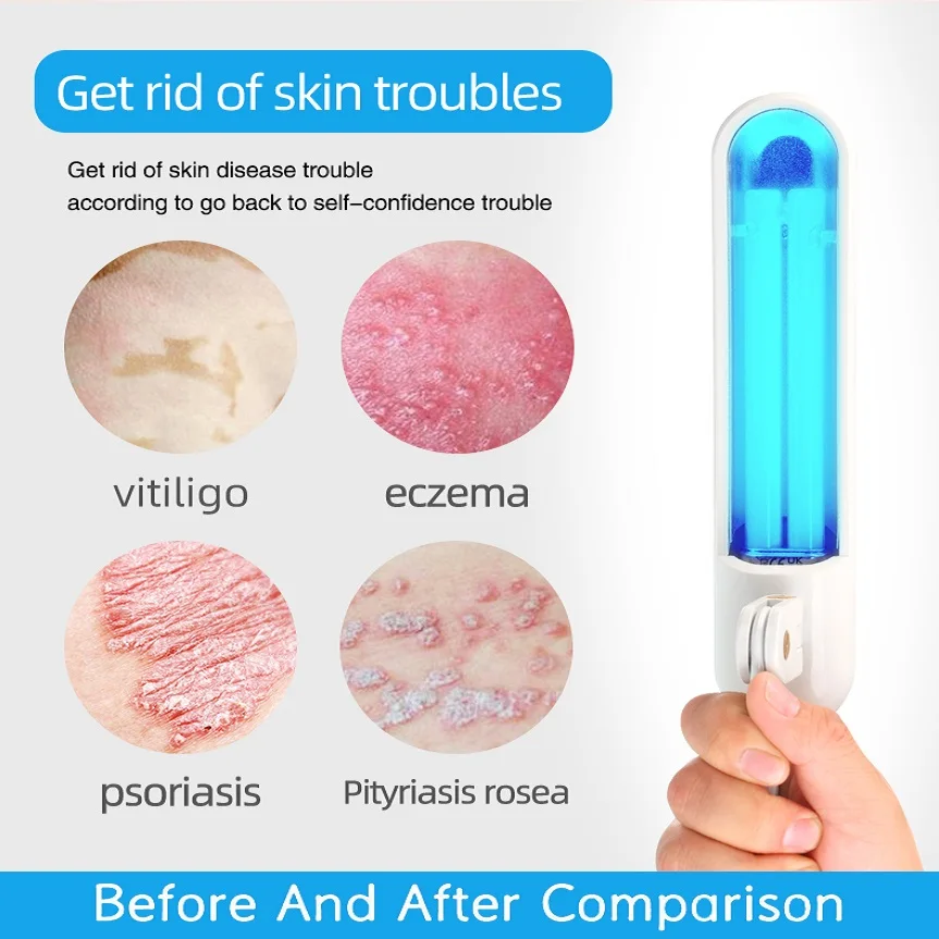 Original 311nm UVB Phototherapy For Vitiligo, Eczema, Psoriasis, UVB Lamp, Skin Problem Treatment Lamp 5