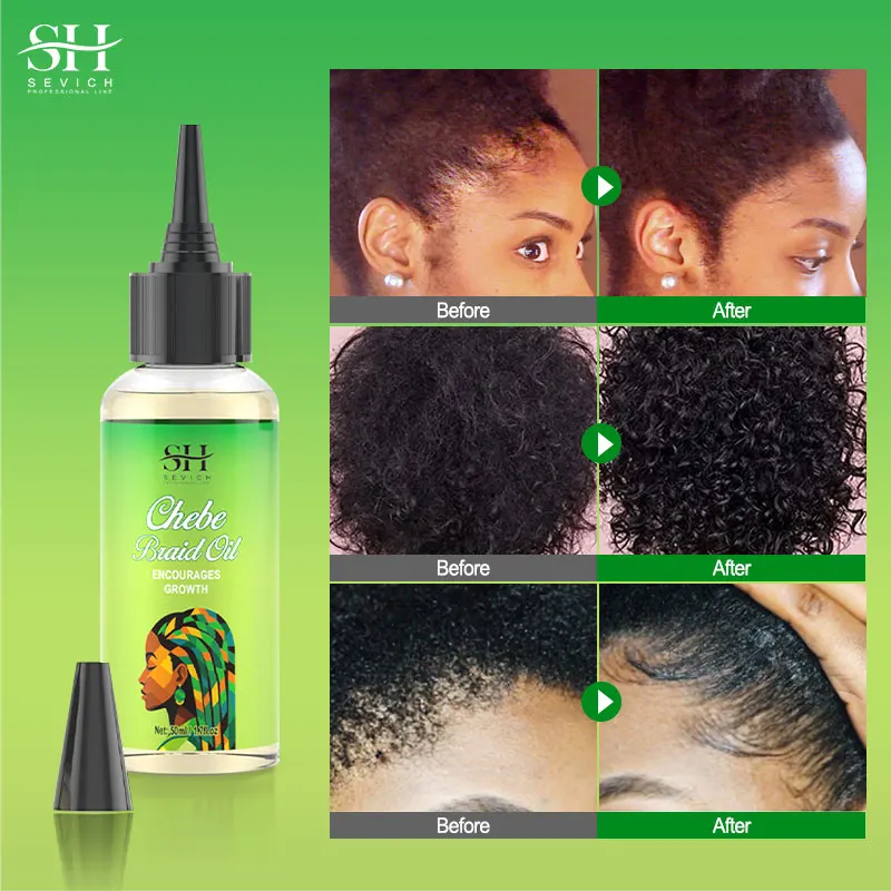 Fast Hair Growth Oil African Crazy Traction Alopecia Chebe Anti scalp itching Anti Hair Break Hair Strengthener Hair Loss Spray