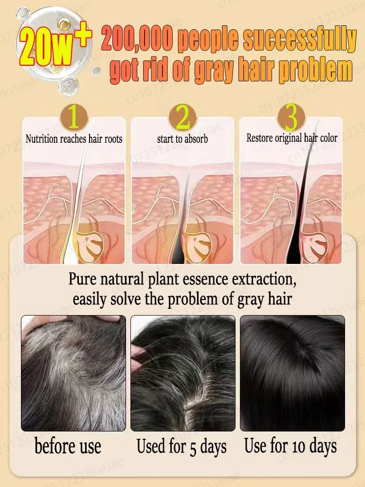 Hair color restorer turn white hair into black hair remove gray hair in 7 days restore natural healthy hair color