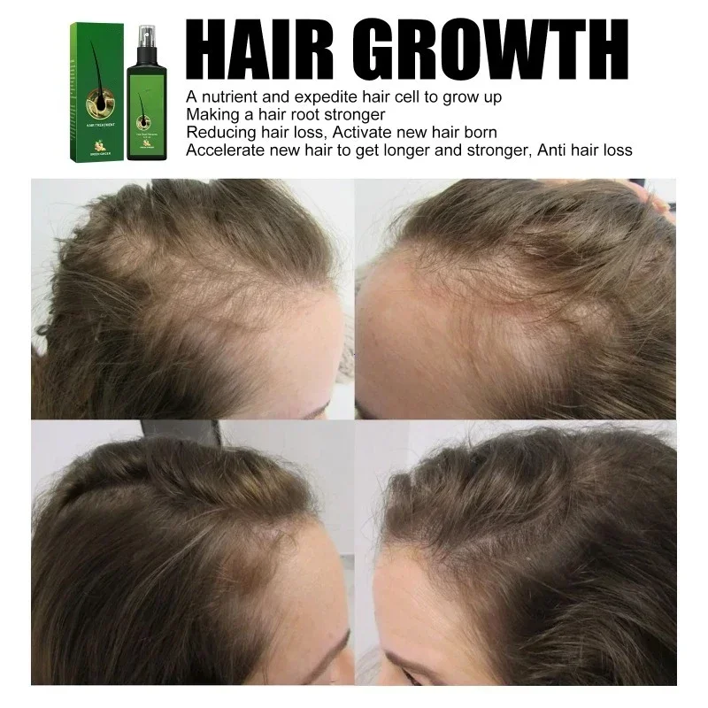 Zenzero naturale Cura dei capelli Olio essenziale Radice Crescere Anti perdita di capelli Siero Liquido Cuoio capelluto Danneggiato Trattamento Riparazione Prodotti per la cura - immagine 5