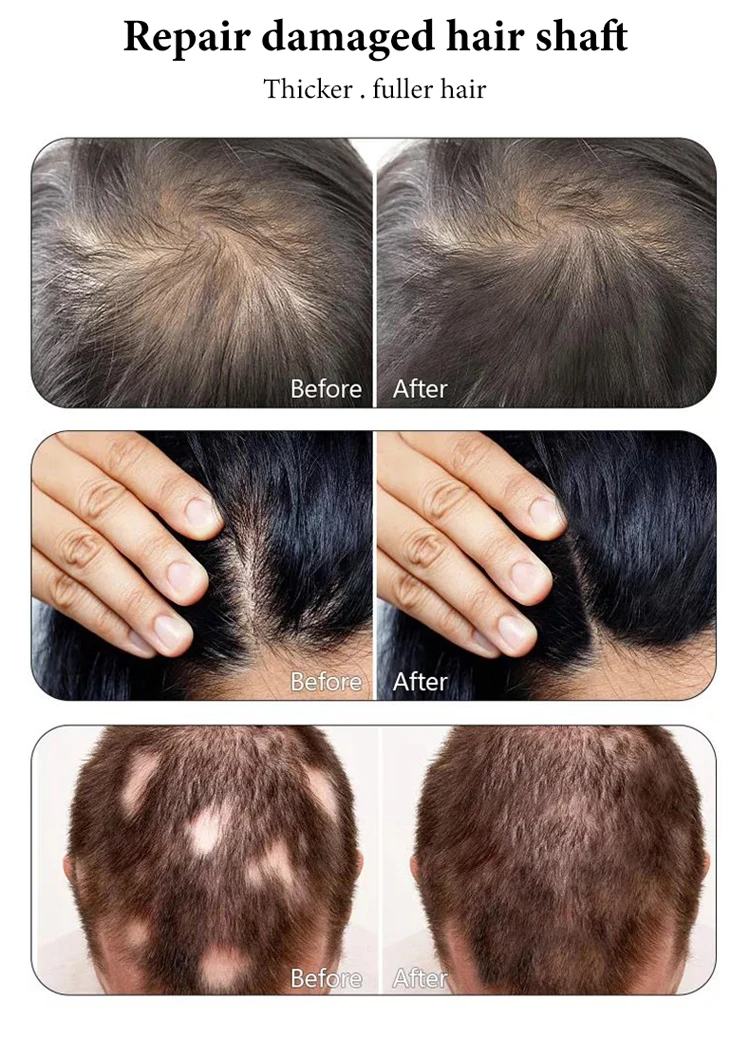 Nanoplastia Alisado BrasileÃ±o Pelo Corto Alisado Brasileño