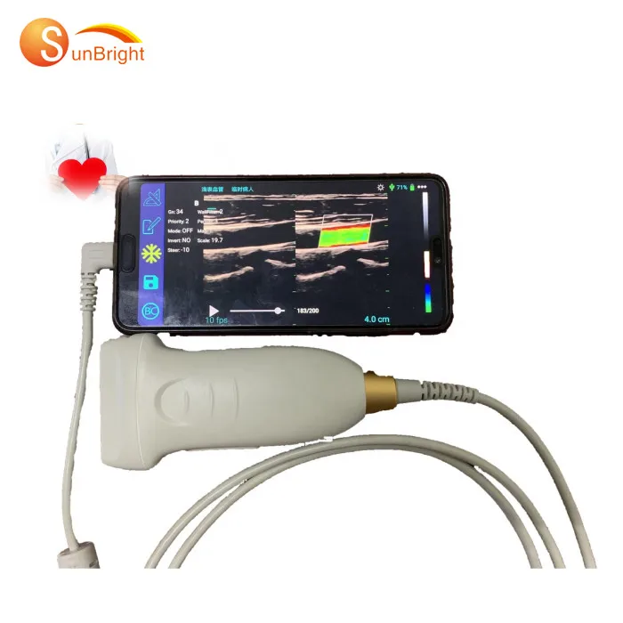 

Portable smart Musculoskeletal Echo Android Ultrasound Probe SUN-D2