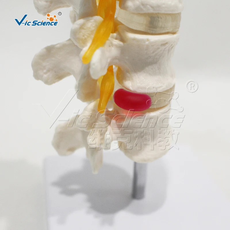 Medical science Four-segment lumbar model
