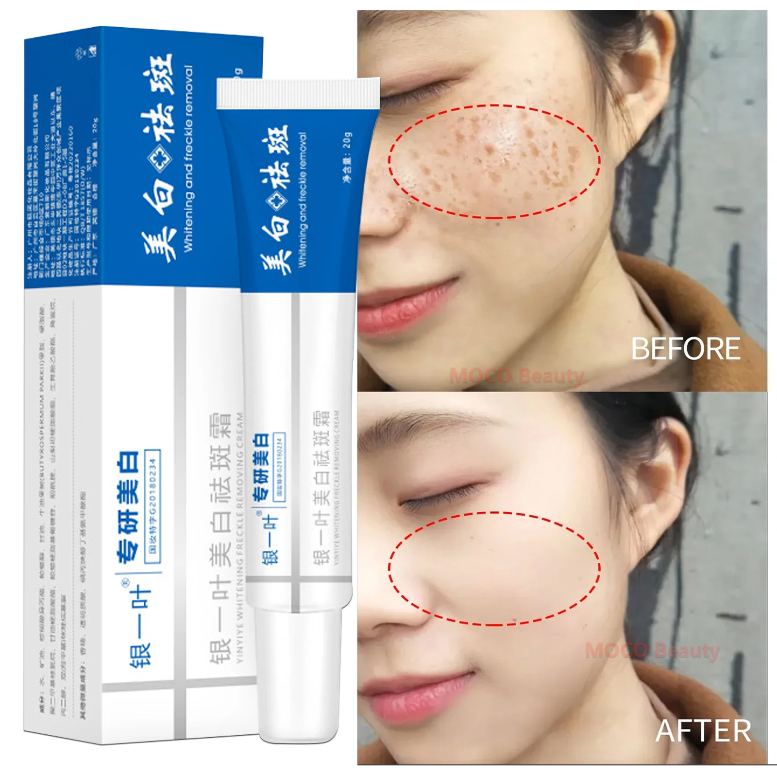 

Effective Whitening Freckles Face Cream Remove Melasma Dark Spots Lighten Melanin Acne Scar Anti-aging Brighten Facial Skin Care