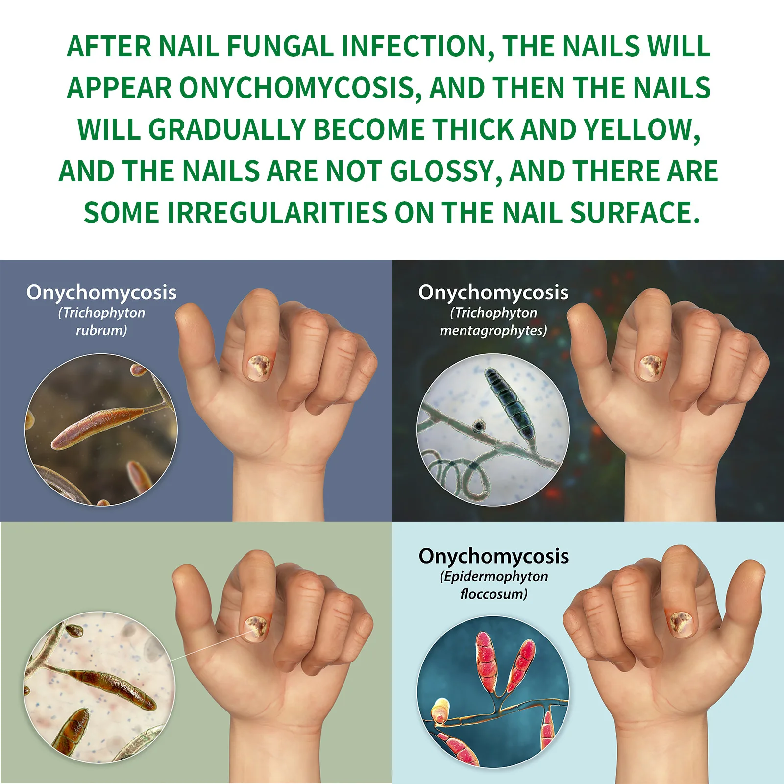 Nail Fungus Remover Personal Health Care Manicure Pedicure Tools Nail Fungal Treatment Device 1-5Pcs