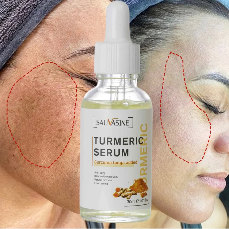 30ML Turmeric Face Serum Whitening Dark Spot Remover Acne Scar Bright