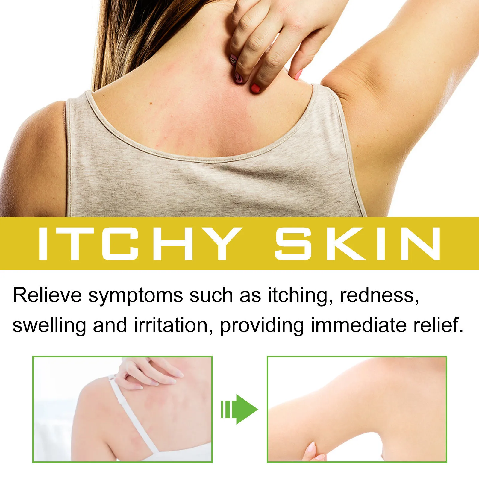 Seborrheic Dermatitis Spray Psoriasis Eczema Fungal Treatment Repair Itching Skin Redness Soothing Eczema Antibacterial Spray