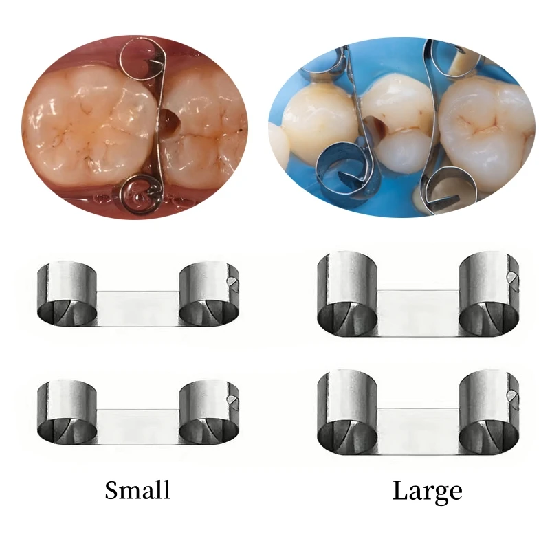20PcsboxDentalSectionalMatrixSystemAdjacentToothProtection