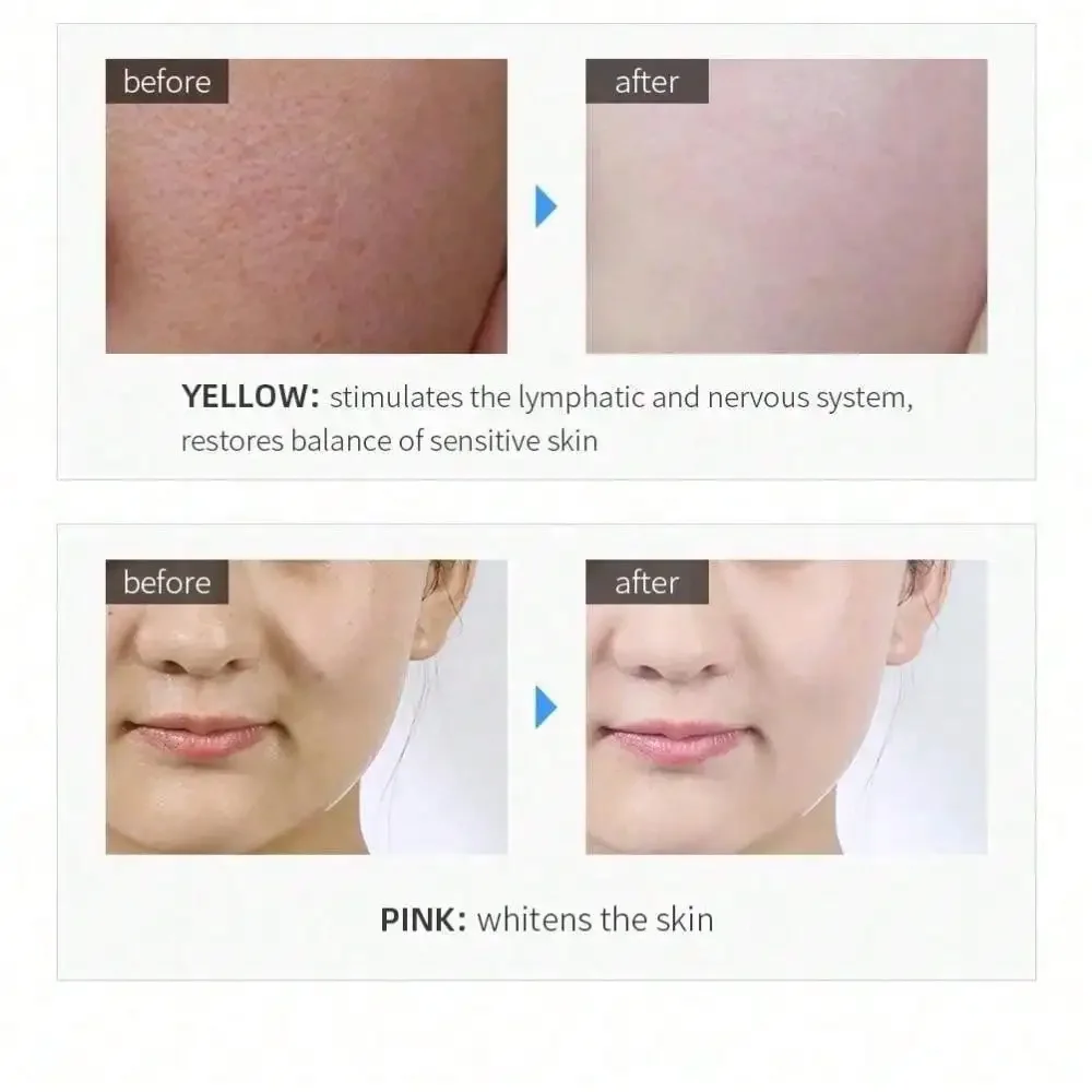 Mini For Face Skin LED Rejuvenation Wand Face Skin Care Massage Beauty Device Led Photon Care Device
