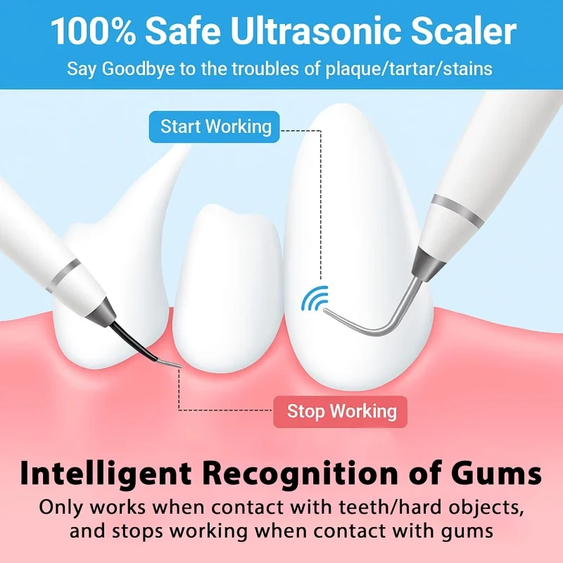 Limpiador dental ultrasónico inteligente para perros y gatos, removedor de sarro