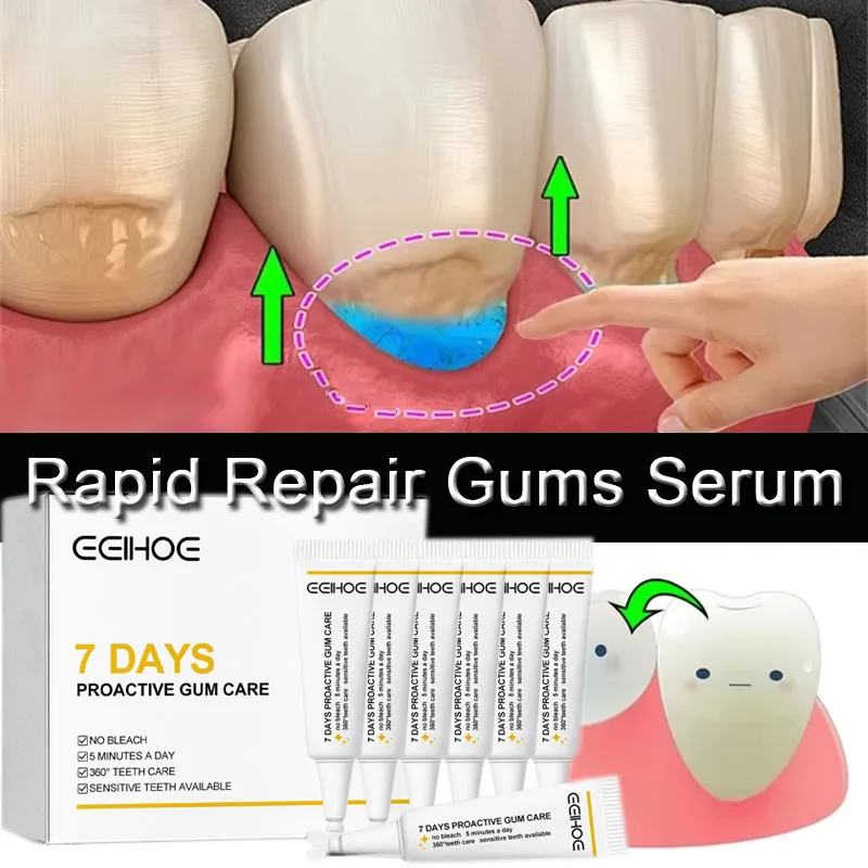 7 Days Rapid Repair Gums Serum Instant Soothing Gel Gum Repair Artifact Relieve Tooth Allergy Dental Caries Cleaning Toothpaste
