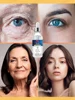 wrinkles disappear become beautiful now 3