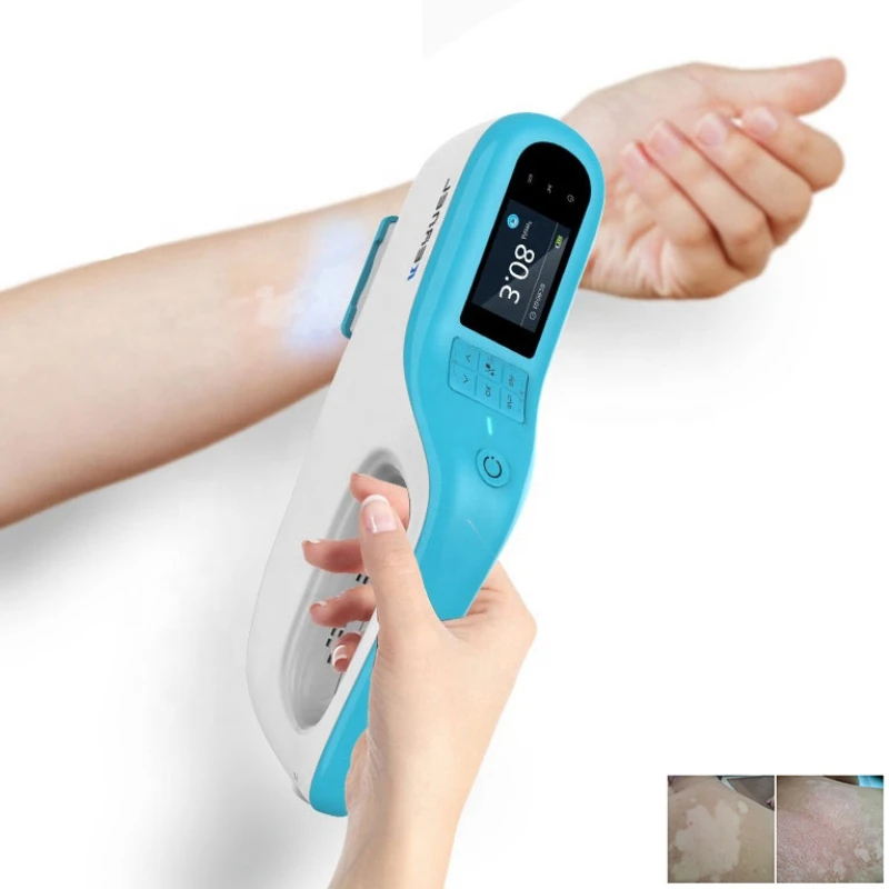 

KN-5000C/d/e/f CE cleared excimer laser 308nm psoriasis vitiligo laser