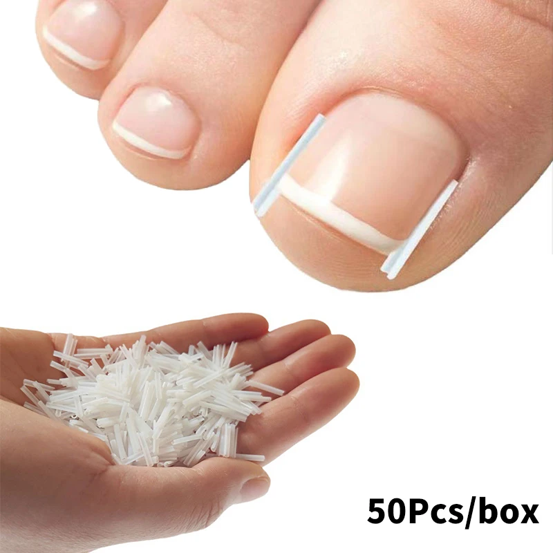 50Pcs Ingrown Toenail Correction Tool Ingrown Toe Nail Treatment Elastic Patch Sticker Straightening Clip Brace Pedicure Tool