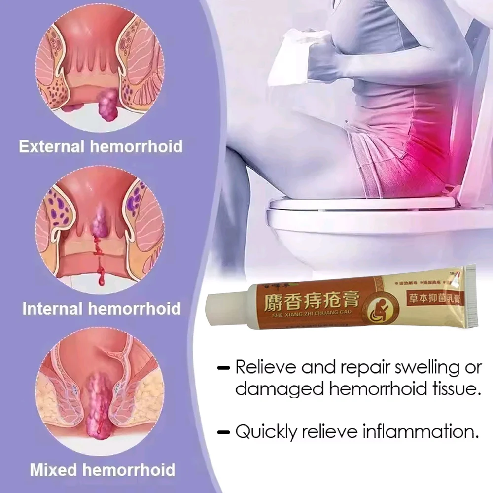 Musk Materials Hemorrhoids Ointment 18g Powerful Hemorrhoids Cream Internal Piles External Anal