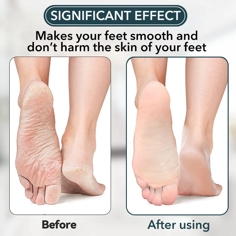 https://ae01.alicdn.com/kf/S69584a78a374476ea439f5575aeacbeaB/Nano-Glass-Foot-Rasp-Heel-File-Hard-Dead-Skin-Callus-Remover-Exfoliating-Pedicure-Care-Foot-File.jpg