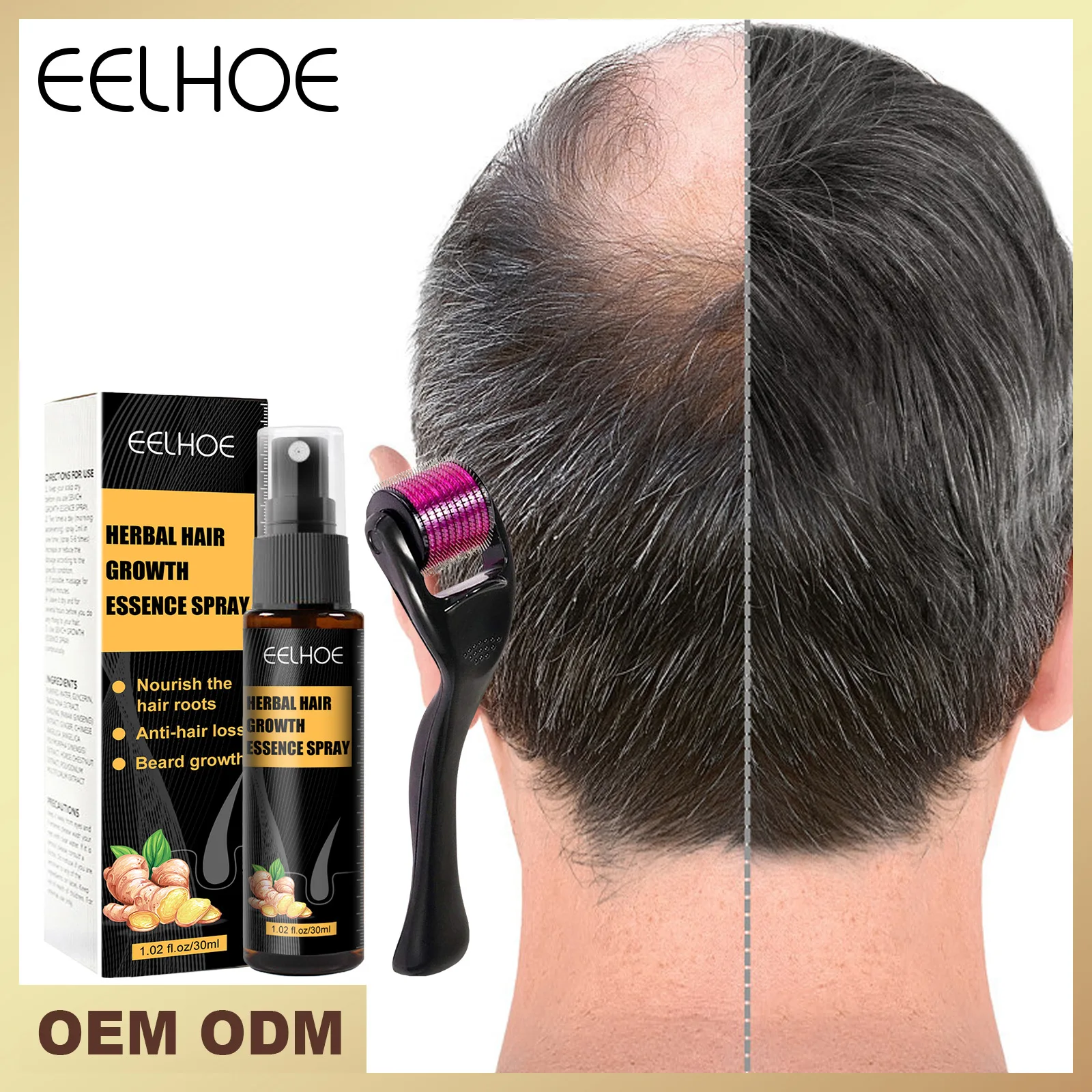 Eelhoe Hair Fall Prevention Nourishing Care Solution Scalp Dense Hair Loss Treatment Breakage Herbal Anti-falling Roller Essence east moon hair care spray moisturizing soft hairs anti hair loss solid hair thick repair hairs root dense