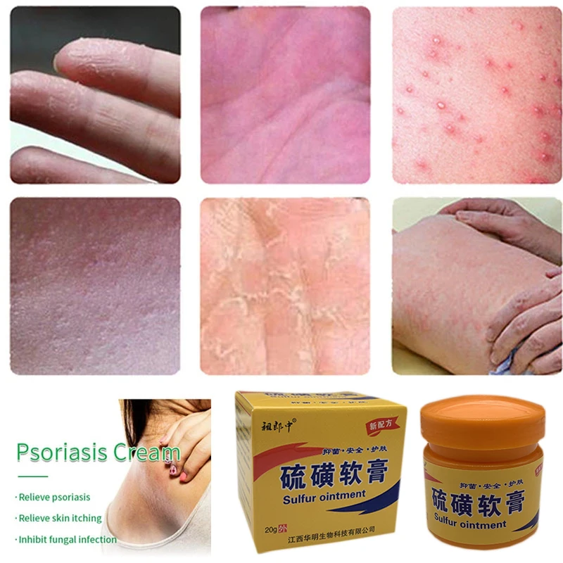 4 Types Sulfur Antibacterial Cream Scabies Repair Balm Eczema Ointment Dermatitis Antibacterial Herbal Formulas Health Care skin care ointment antibacterial anti fungal cream