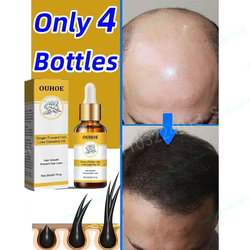 

Hair Care Hair Growth Essential Oils Essence Original Authentic 100% Hair Loss Liquid Health Care Beauty Dense Hair Growth Serum