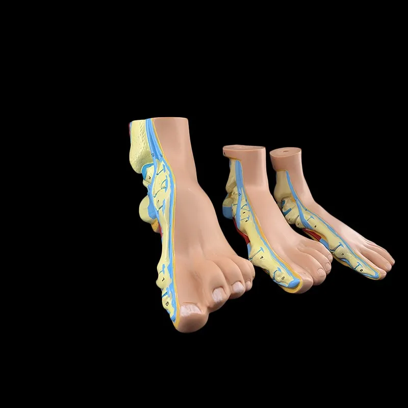 

3pcs/set Human Foot Palm Muscle Model Normal Foot Flat Feet Bow Foot Combined Anatomical Model