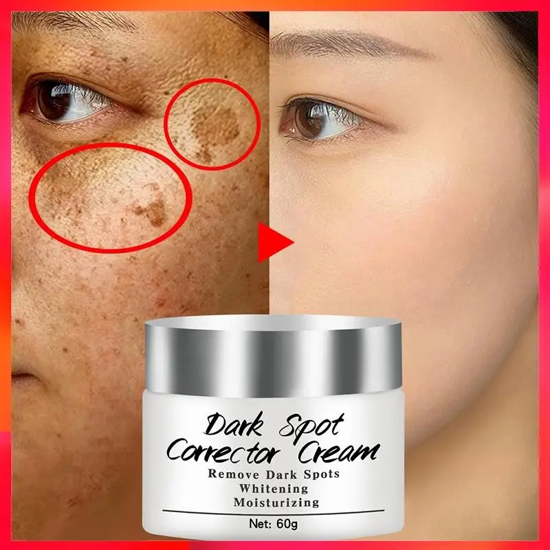 Newest Dark Spots Corrector Cream Whitening Facial Cream Repair Fade Freckles Remove Dark Spots Melanin newest deburring external chamfer tool stainless steel remove burr tools for metal drilling tool