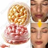 Freckle Whitening Serum Black Dots Melasma Remover Anti Brown Stain Lighten Pigmentation Moisturizing Skin Care Korean Products 1