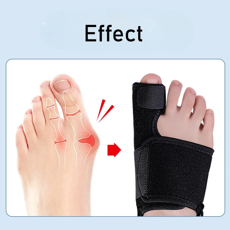 toe separators toe corrector manicure pedicure tools flexible splint toe separator hallux valgus bunion corrector orthotics feet bone thumb adjuster correction pedicure straightener