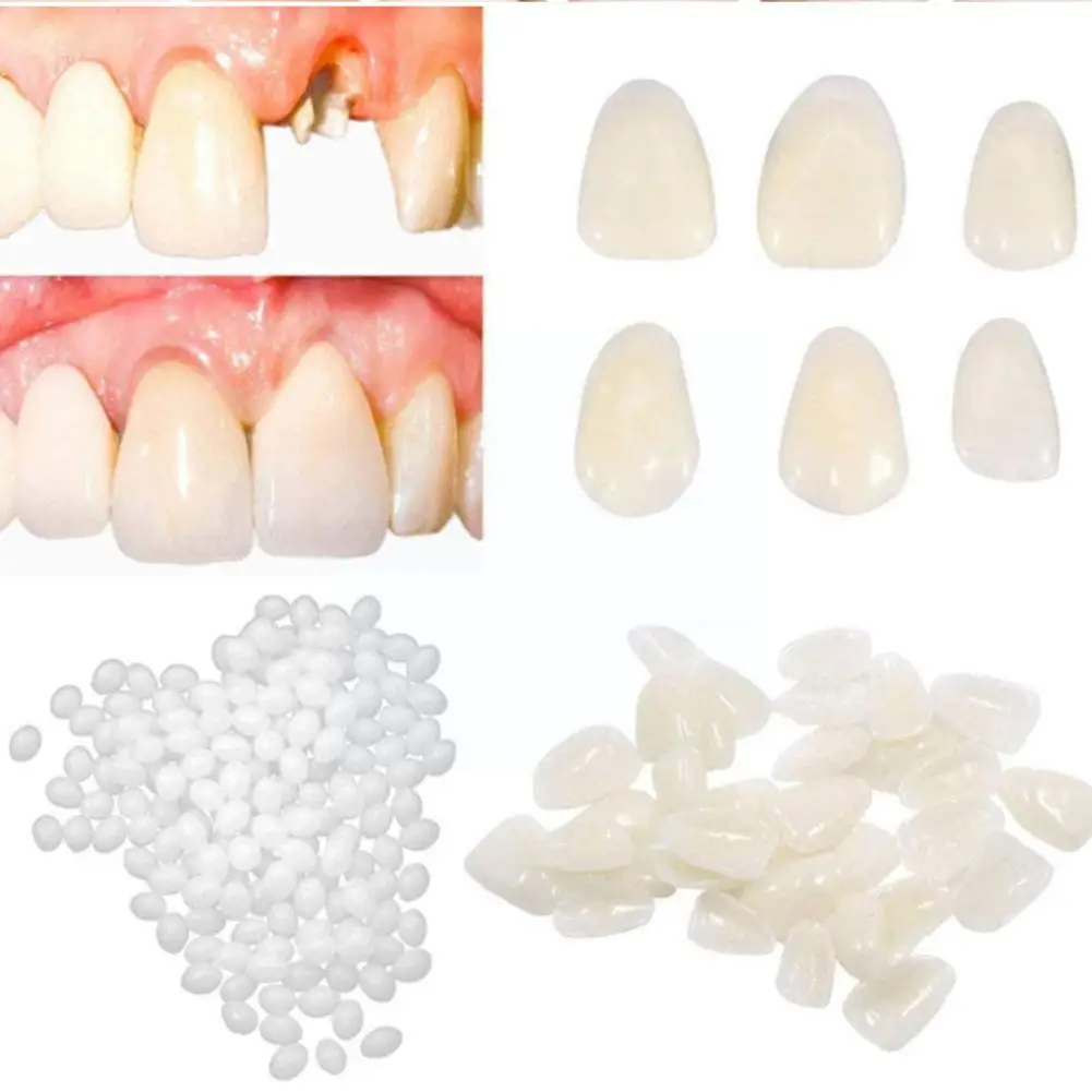 

Resin 5g/10g/15g/20g Temporary Tooth Repair Kit Teeth Adhesive Gaps Glue Solid Denture FalseTeeth Whitening Teeth Tooth Bea T0Z6