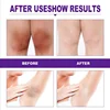 Brightening Cream For Dark Skin Effective Lighten Thigh Inner Bleach Remove Melanin Private Part Elbow Knees Brighten Skin Cream 4