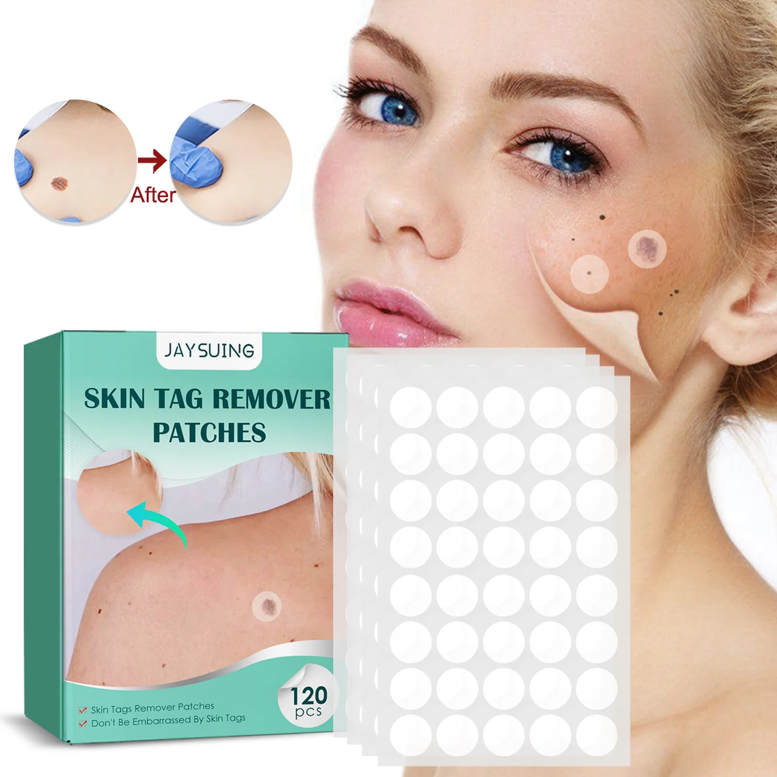 jaysuing-skin-tag-remover-patches-natural-safe-leaf-extract-for