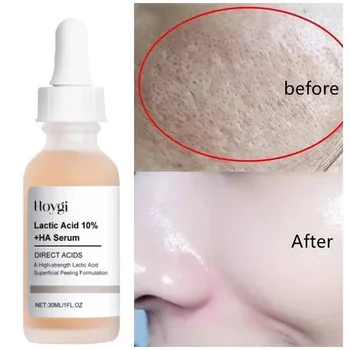 Lactic Acid Shrink Pores Serum Fast Large Pores Removal Firming Skin Essence Firming Smoothing Nourishing Repair Face Skin Care