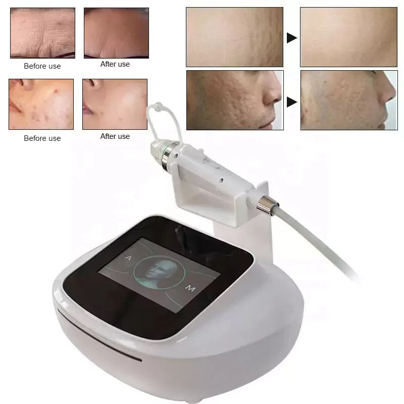 RF Fractional Microneedle Machine with Cold Hammer 2023 RF Radio