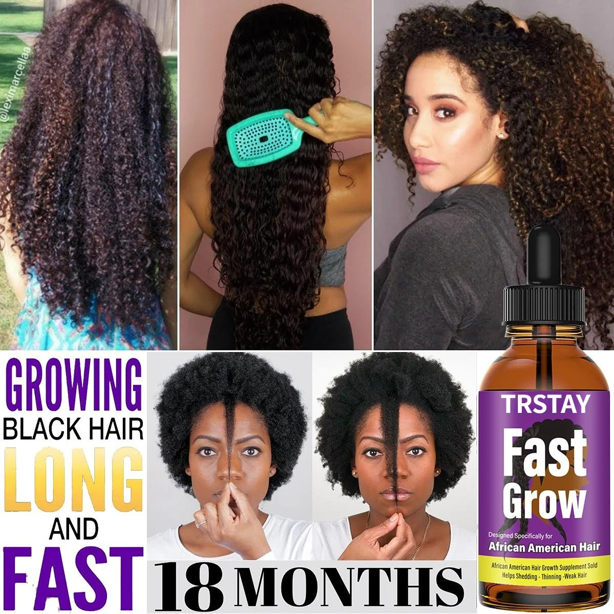 Anti Alopecia Oil Hair Growth Essential Oils for Black Women Essence