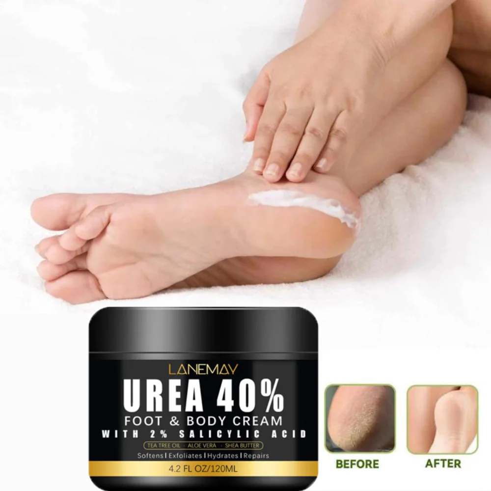 

Urea Frost Deep Moisturizer Amp Repair For Dry Feet Locks Water Nourishes Elasticity Boost Skin Recovery Solution