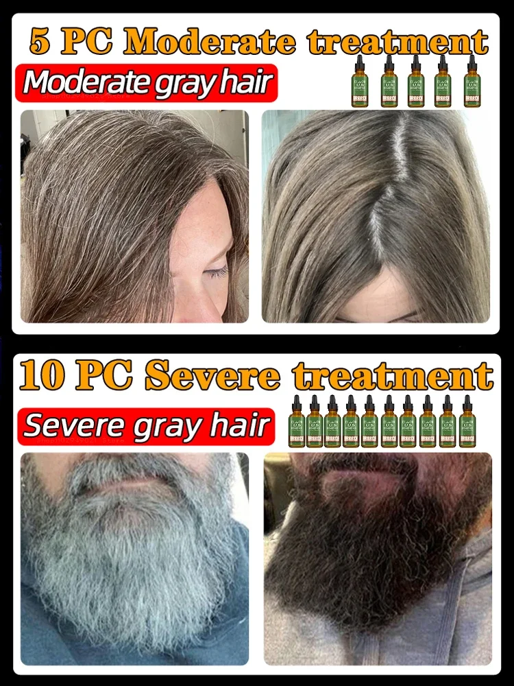 Ƽ ׷     , ȭƮ , 30ml
