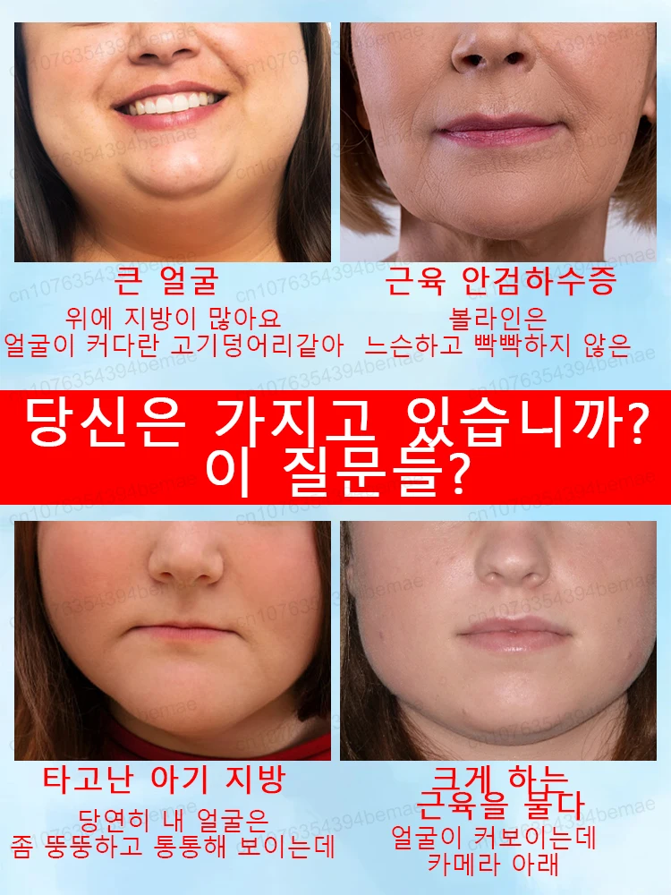   ũ Ÿ    , Oedema  Ʈ ŸƮ, V   , ڿ ,  