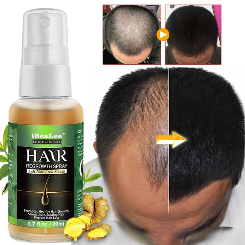 Hair Nutrition Liquid Hair Growth Liquid Anti Hair Loss Essential Oil