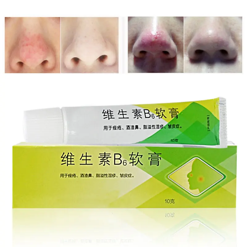 Rosacea Cream Red Nose Ointment Remove Blackhead Acne Cream Skin Care