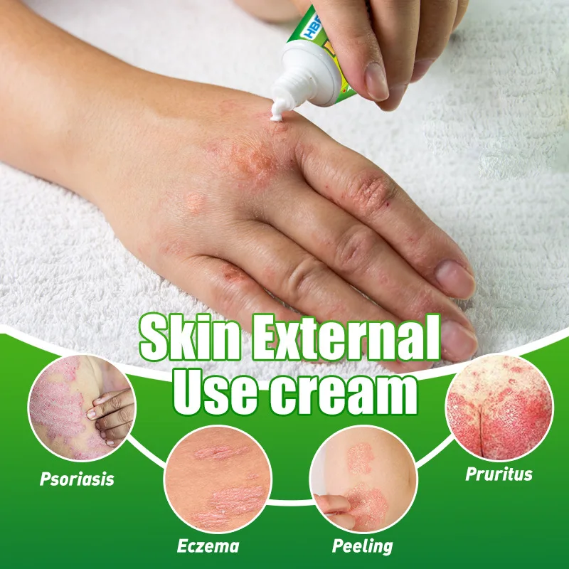 Antiseptic,Health & beauty,Herbal Moss Cleansing Cream for Skin Topical Care Cream Damp Poison Clearing Herbal Itching
