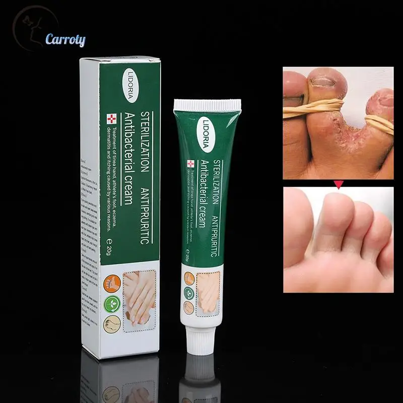 

20G Anti Fungal Infections Hand Foot Cream For Athlete's Foot Pain Relief Beriberi Itch Erosion Peeling Blisters Feet Ointment