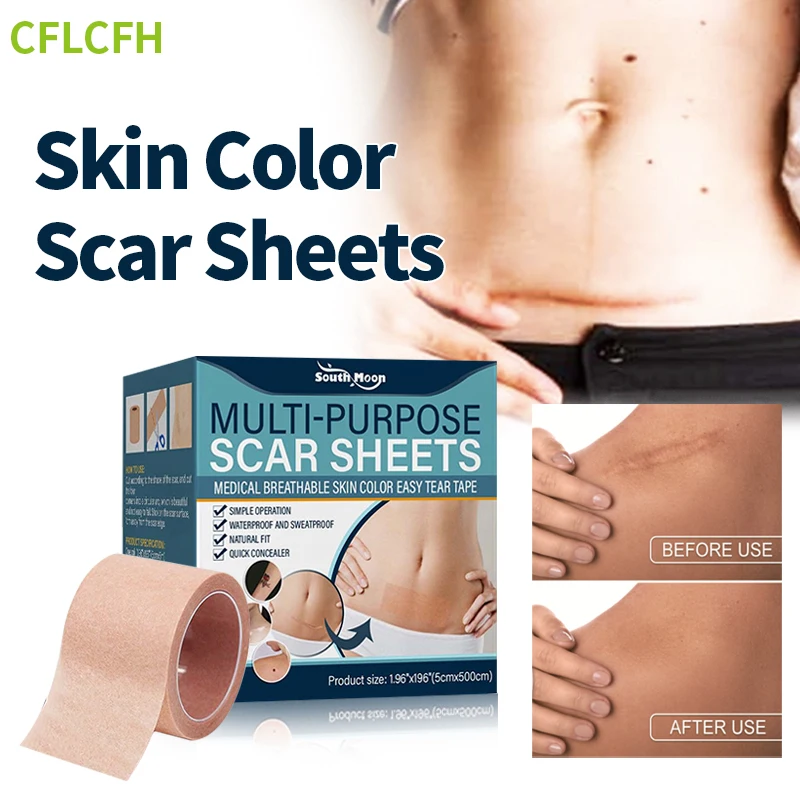 

Scar Sheets Multi-purpose Skin Damaged Repair Sheet Burn Scar Removal Fade Scars Waterproof Care Tape Skin Conceal Patch