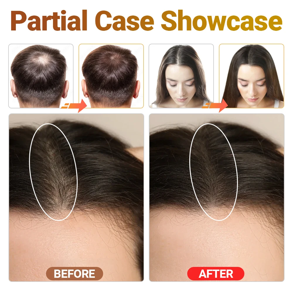 Tri-Chroma Photon Dispositivo per Terapia Dei Capelli Professionale LLLT Laser Crescita Dei Capelli Trattamento Anti Perdita Dei Capelli Diradamento Del Cuoio Capelluto Alleviare Lo Stress - immagine 6