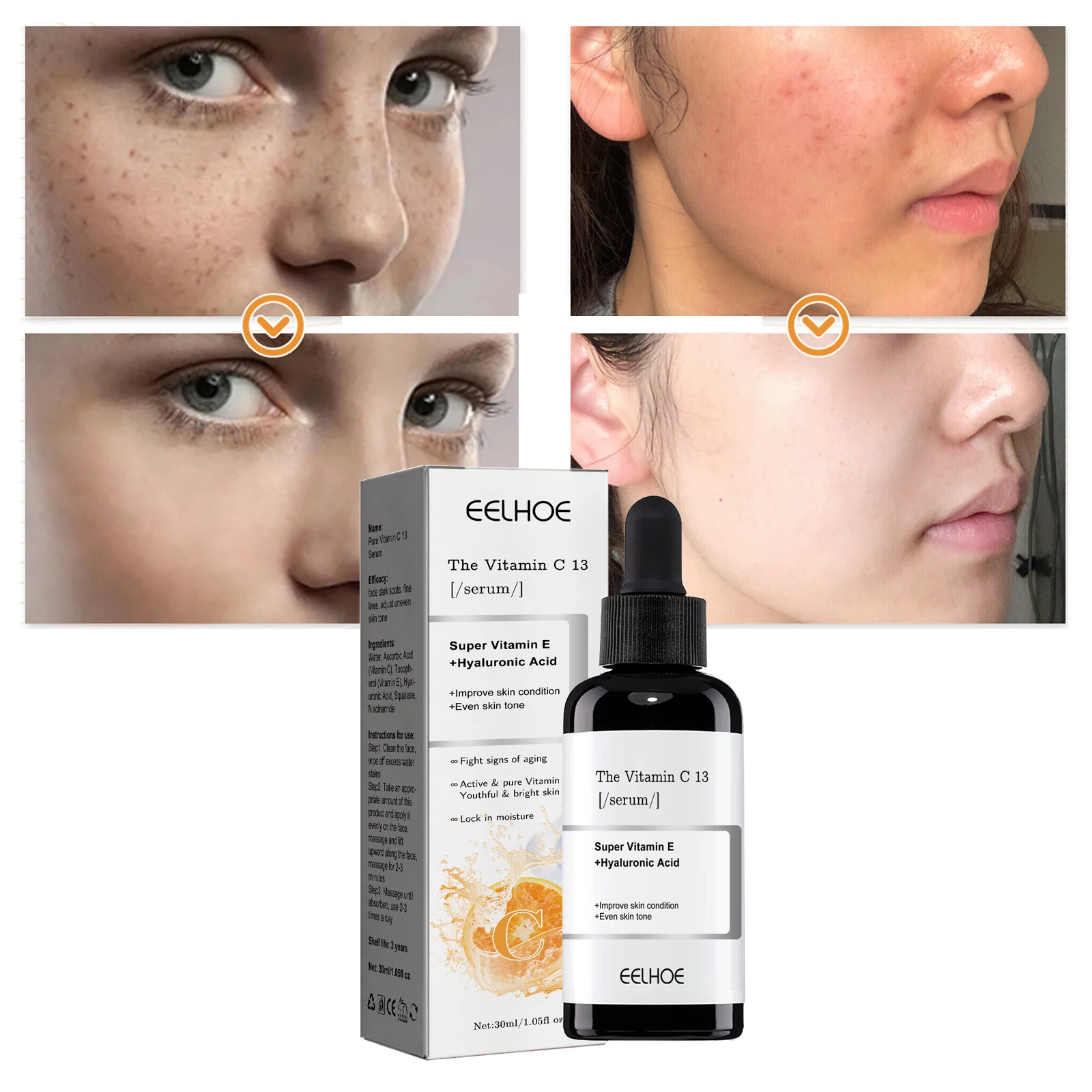 

Vitamin C Serum Whitening Freckle Remove Pigment Melanin Anti Aging Dark Spot Corrector Brighten Moisturizing korean skin care