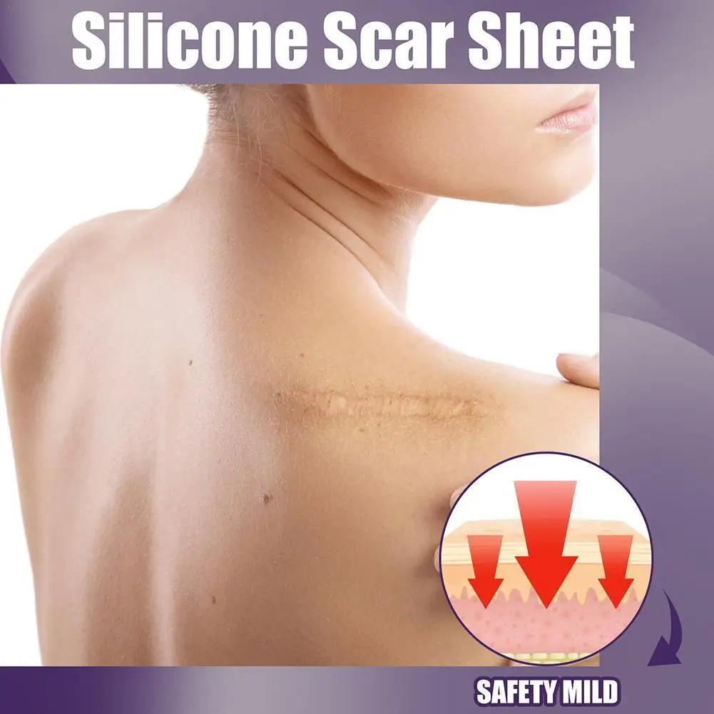 

Skin Color Scar Sticker Reusable Silicone Scar Removal Patch Patch Burn Repair Gel Soft Surgical Strip Self-adhesive