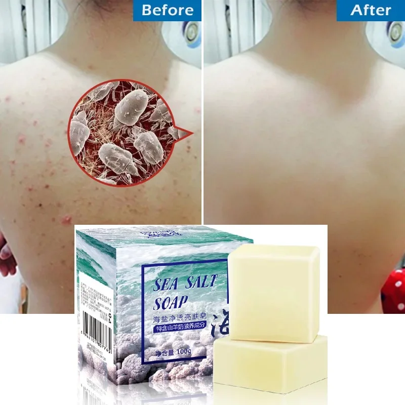 Removal Pimple Pores Acne Treatment Sea Salt Soap Cleaner Goat Milk Moisturizing Face Care Wash Basis for Skin Care Whitening handmade soap face wash