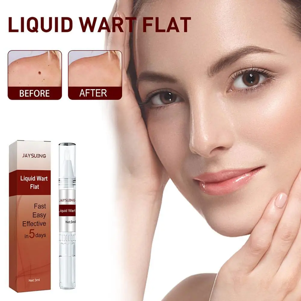 3PCS Painless Mole Wart Remover Liquid Wart Flat Skin Tag Removal Wart
