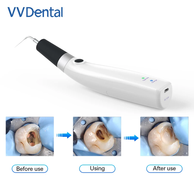 

VVDental Dental Endo Ultra Activator Wireless Endodontic Irrigator Ultrasonic Handpiece Dentistry Root Canal Instruments